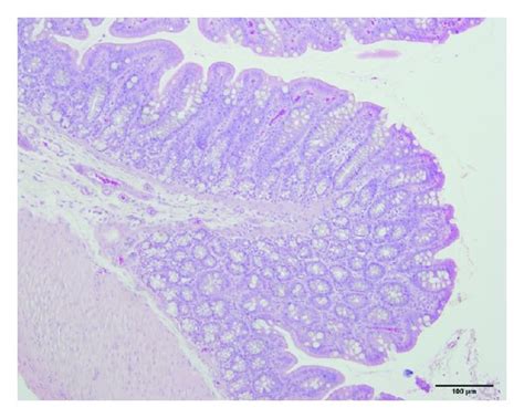 Photomicrographs Of The Colons Of Control Rats A And B A Rat