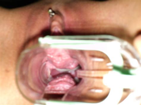 Homemade Gallery Porn Pic