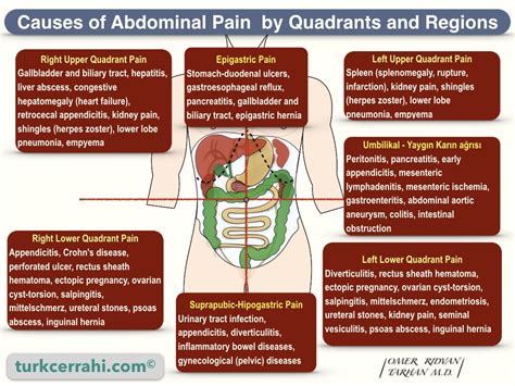 Quadrants and Regions of Abdomen | turkcerrahi.com/en