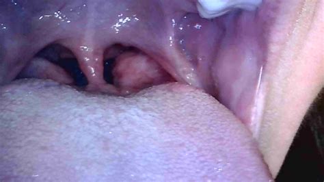 Brunette Milf Endoscope ThisVid