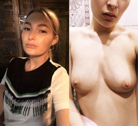 Another Collection Of Fresh Faced Before And Afters Agsags Porn Pic