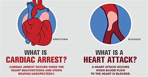 Heart Attack Vs Cardiac Arrest Know The Differences