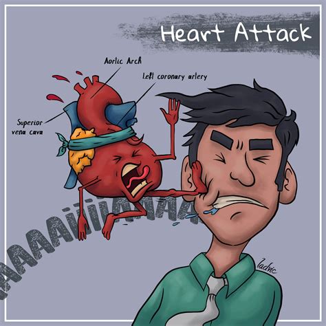 Attack