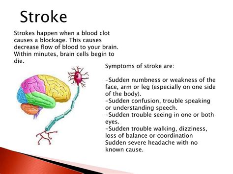 Ppt Thrombophlebitis Powerpoint Presentation Free Download Id 2246423