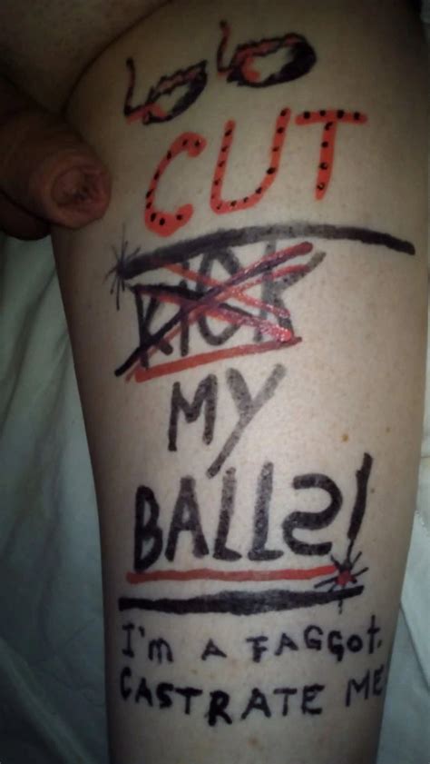 After The Castration 20 Nude Pics XHamster