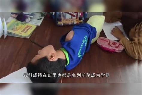 男孩生来就没有四肢，医生说活不过4天，却靠打游戏获百万奖金四肢医生奖金