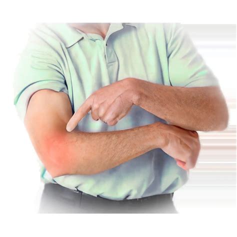 Elbow Instability - Dr Bothma