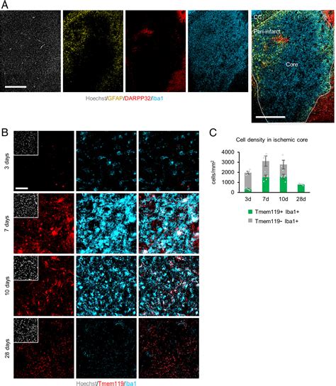 Direct Neuronal Conversion Of Microglia Macrophages Reinstates