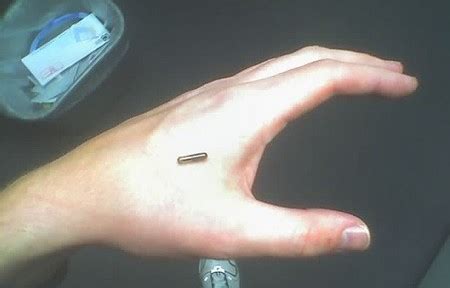 Médico implanta microchips en sus manos para una vida más fácil Chapin TV