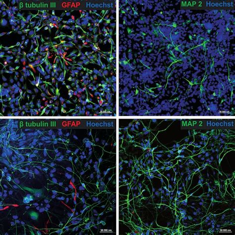 Human Neural Stem Cell Population Derived From Ipsc Hips Nsc Cultured