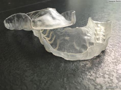 Капа для зубов ретензионная, с перемещением, от бруксизма - «3 капы ...