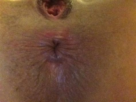 Hope Solo Naked Photos Part Thefappening