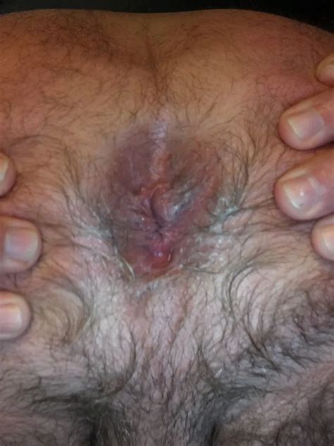 Ass Asshole 34 Nude Pics XHamster