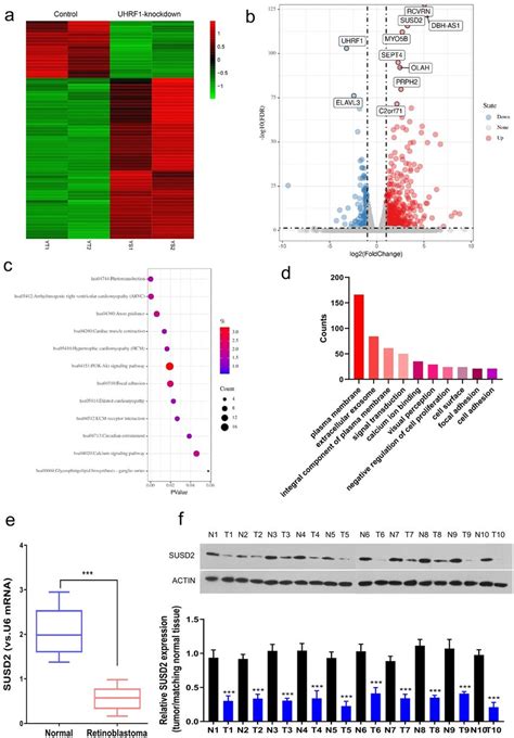 SUSD2 Is Downregulated In Retinoblastoma Tissues And Cells