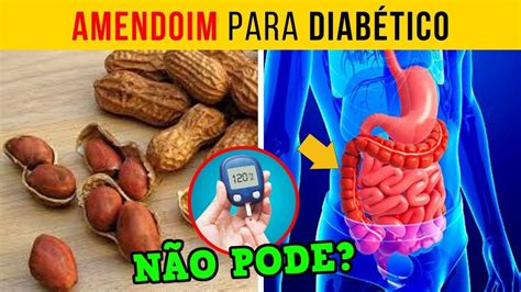 Diabetico Pode Comer Amendoim Torrado - Diabético Pode Comer Amendoim 🚨VEJA ISSO URGENTE🚨 Amendoim Para ...