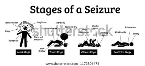 Stages Phases Seizure Illustrations Depicts Phases Stock Illustration 1173806476