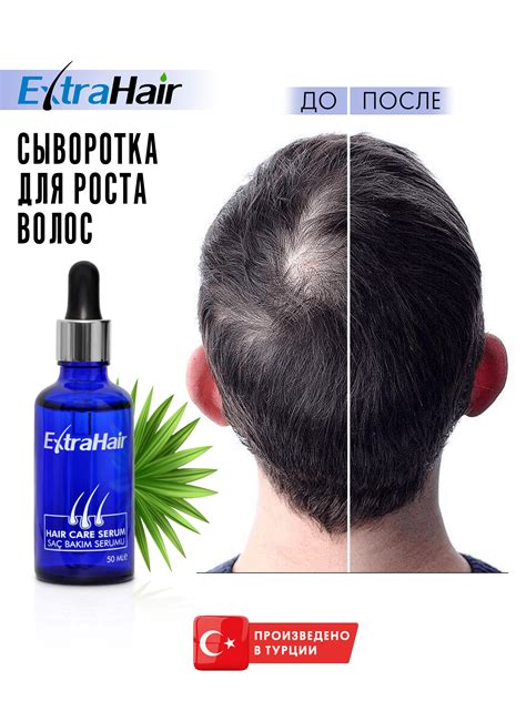 Charismo Dekohair - Лосьон для Роста Волос купить на OZON по низкой цене
