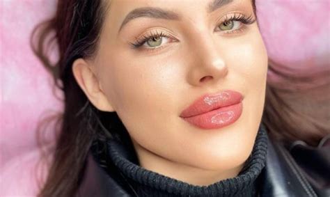 Russian Lips Augmentation des lèvres à Nantes 44 Par Myriam Estheca