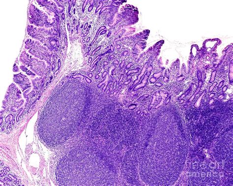 Pathology Outlines Histology-small Intestine, 51% OFF