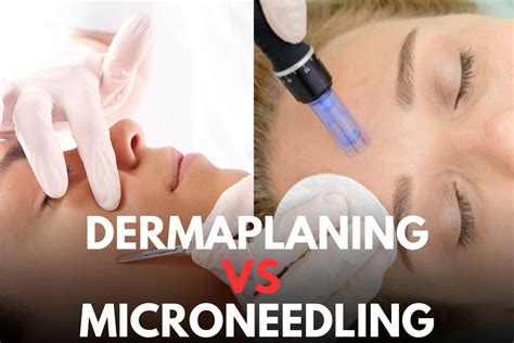 Dermaplaning Vs Microneedling Fitness Beauty Art