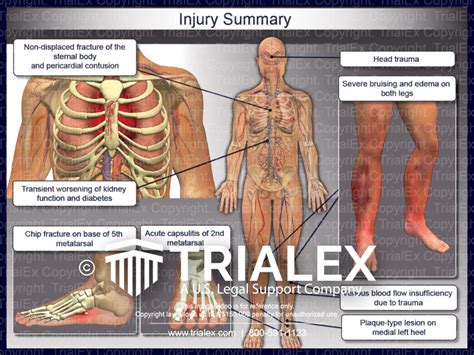 Icd 10 Code For Superficial Injury Left Leg