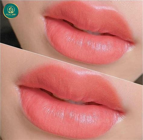 Phun M I Collagen Ph B Ng Xu H Ng Th M M Hot Nh T Hi N Nay Th M M Vi N Hoa Anh