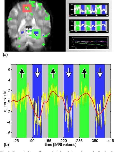 Pdf Self Regulation Of Local Brain Activity Using Real Time