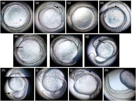 Zebrafish Embryo Stages