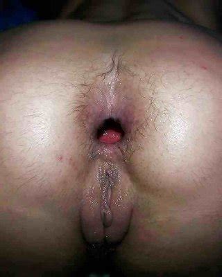 Dirty Ass Gape Porn Pictures Xxx Photos Sex Images Pictoa