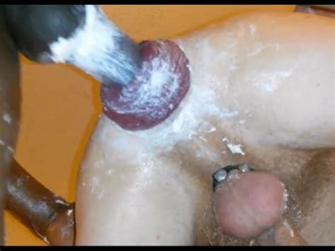 Fisting And Fucking A Prolapsed Cunt Gay Bizarre Porn At Thisvid Tube