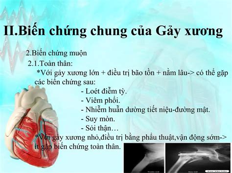 B Dc Gay Xuong B Nh Ngo I Khoa Ppt