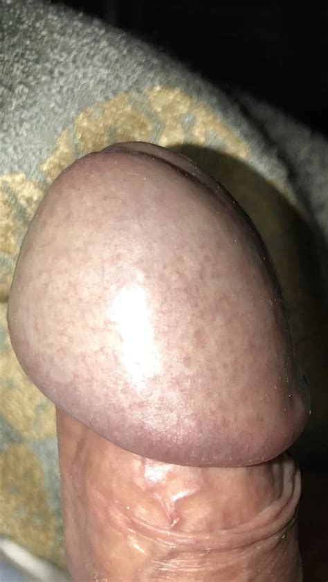 Big Cock Head 22 Nude Pics XHamster