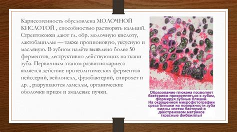 Анаэробные бактерии - презентация онлайн