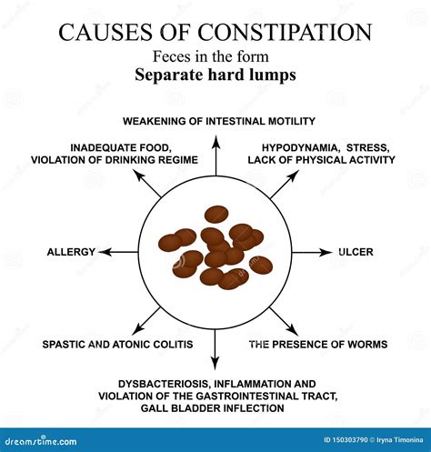 Causes Of Constipation In Humans. Illustrations Of Medicines. Medical