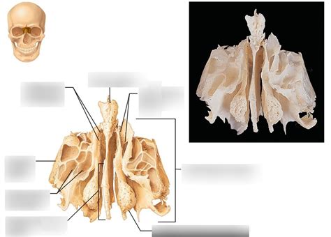 Ethmoid Bone Diagram Quizlet