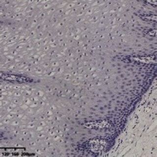 Ihc Staining Of Macc C Met And Cyclin D In Escc Tissues And Normal