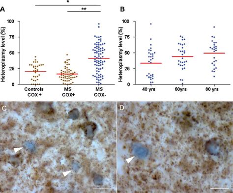 MtDNA Deletions Are Present Within Neurons In MS A Following Complex