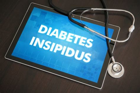 Diabetes Insipidus Causas Sintomas E Tratamentos Dicas De Saúde