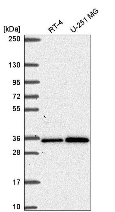 Gemin 2 Polyclonal Antibody Invitrogen™ 100 μl Unconjugated Fisher