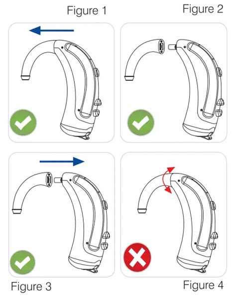 Ear Technic Placing Removing Tamperproof Ear Hook User Guide