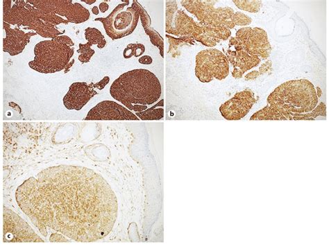 Immunohistochemical stains. A panel of immunohistochemical stains ...