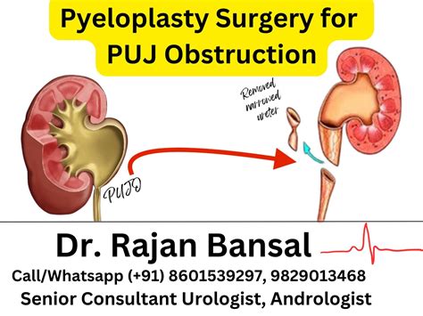 New boarding procedures at hynes station are now explained 5