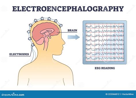 Electroencephalography Or EEG As Brain Activity Monitoring Outline ...