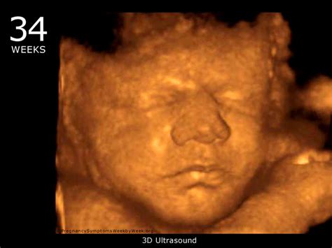 weeks pregnant pregnancy symptoms pregnancy symptoms week  week