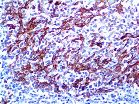 CD138 Antibody (EP201) - Bio SB