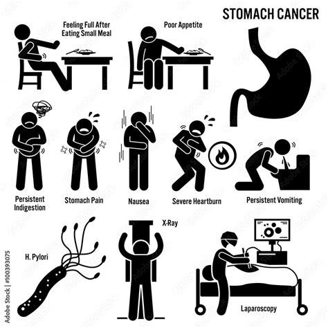 Stomach Cancer Symptoms Causes Risk Factors Diagnosis Stick Figure