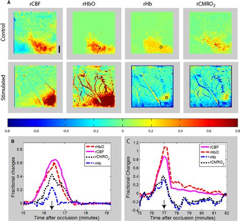 A Maps Of Changes In Relative Blood Flow RCBF Relative