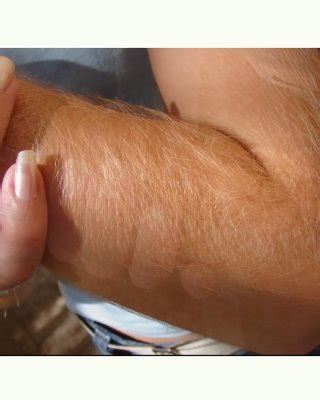 Hairy Arms Collection Porn Pictures Xxx Photos Sex Images Pictoa