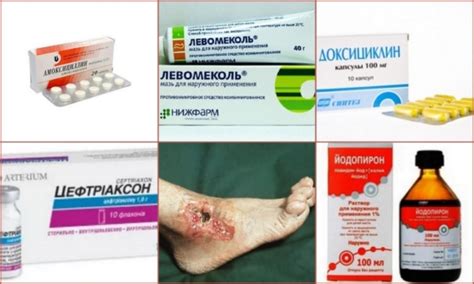 Антибиотики при трофических язвах нижних конечностей - описание препаратов