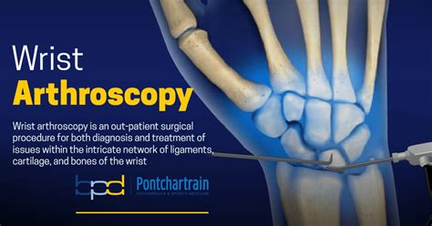 Wrist Arthroscopy Brandon P Donnelly MD